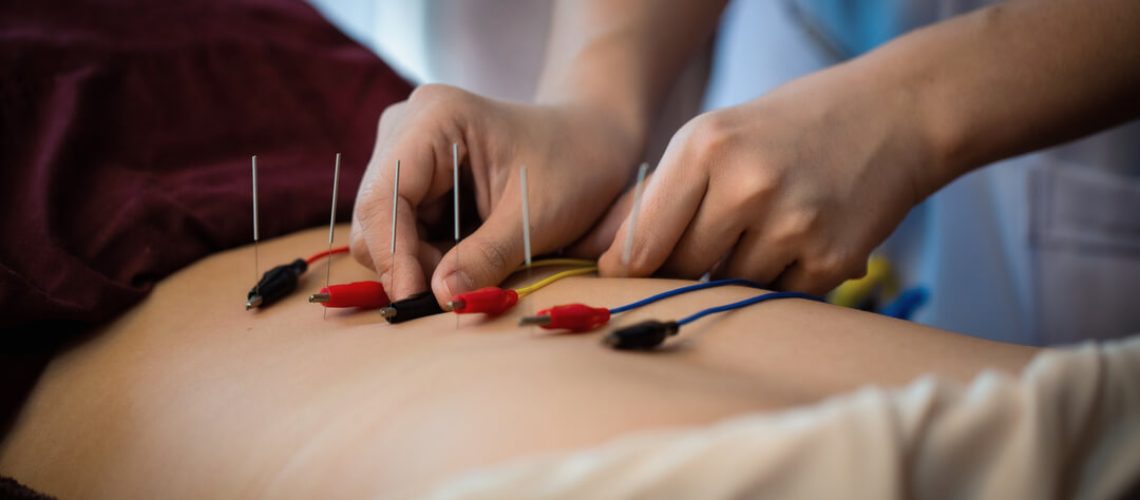 Electroacupuncture